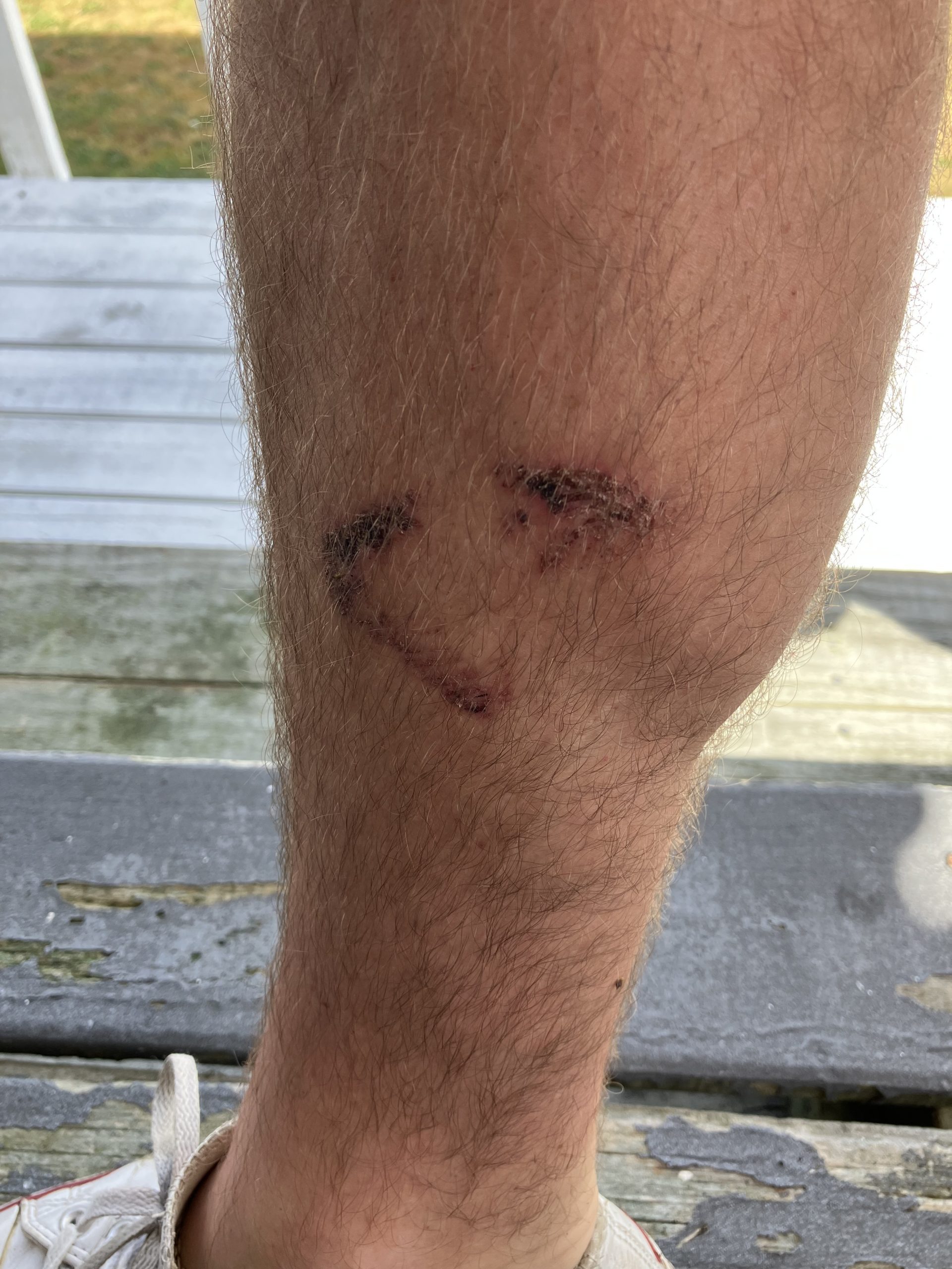 Swimmer does battle with eel Greymouth Star